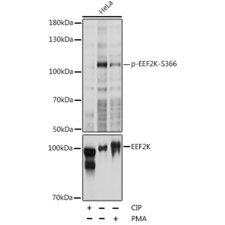 Western Blot - Anti-EEF2K (phospho Ser366) Antibody (A87764) - Antibodies.com