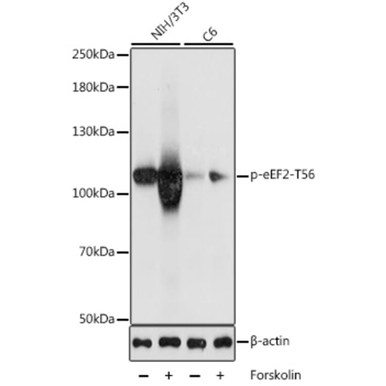 Western Blot - Anti-EEF2/Elongation factor 2 (phospho Thr56) Antibody (A87765) - Antibodies.com
