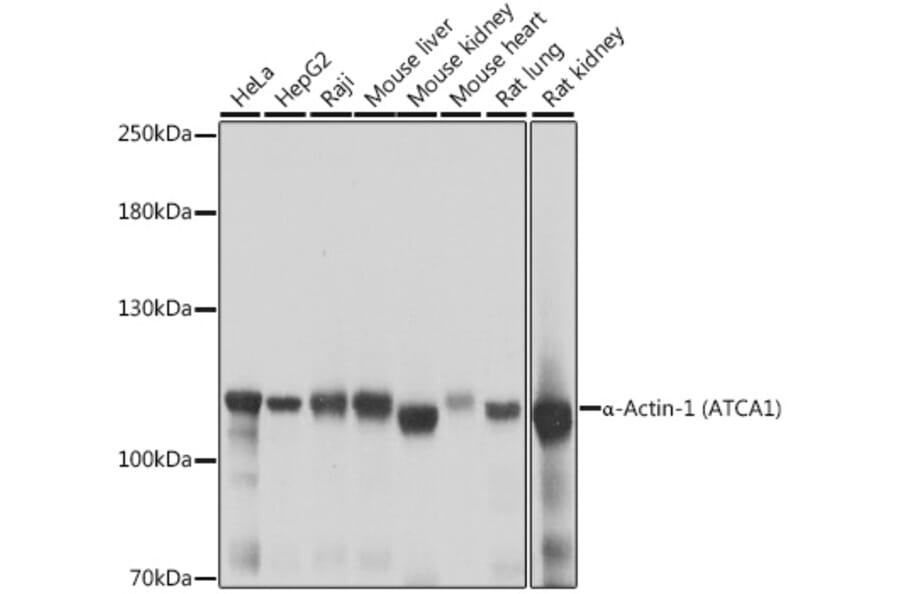 Western Blot - Anti-alpha Actinin 4 Antibody (A87766) - Antibodies.com