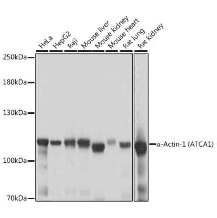 Western Blot - Anti-alpha Actinin 4 Antibody (A87766) - Antibodies.com