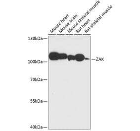 Western Blot - Anti-ZAK Antibody (A87767) - Antibodies.com