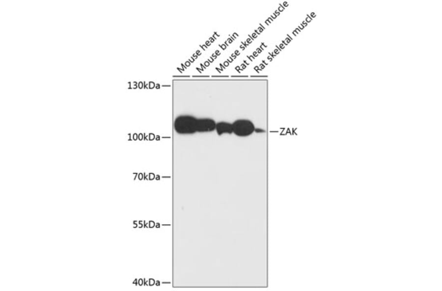 Western Blot - Anti-ZAK Antibody (A87767) - Antibodies.com