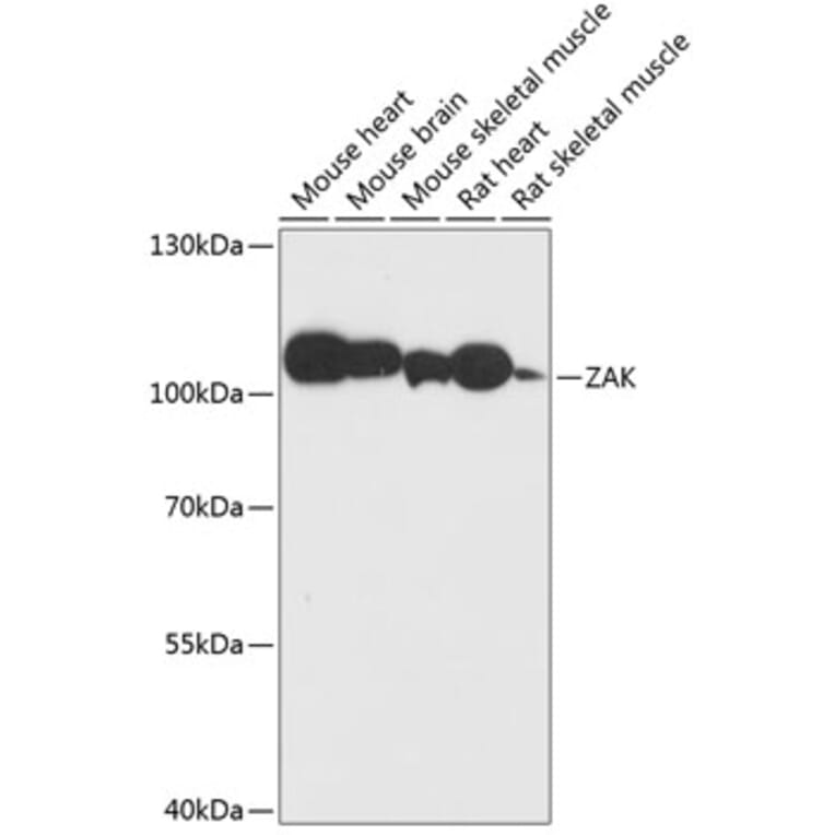 Western Blot - Anti-ZAK Antibody (A87767) - Antibodies.com