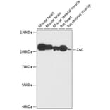 Western Blot - Anti-ZAK Antibody (A87767) - Antibodies.com