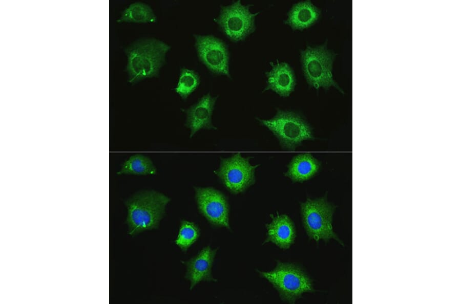Immunofluorescence - Anti-ZAK Antibody (A87767) - Antibodies.com