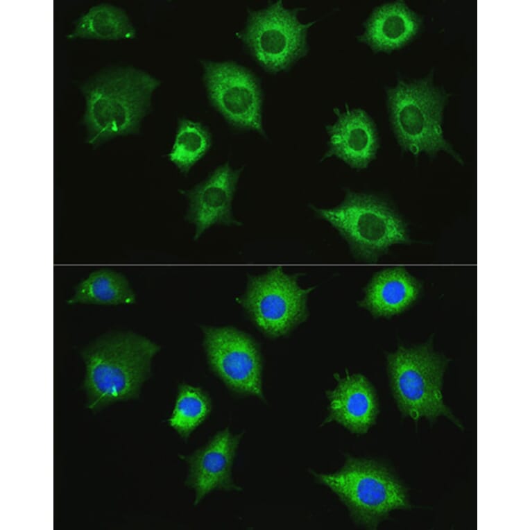 Immunofluorescence - Anti-ZAK Antibody (A87767) - Antibodies.com