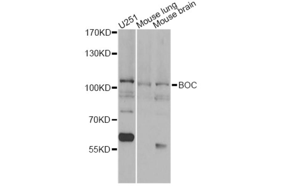 Western Blot - Anti-BOC Antibody (A13446) - Antibodies.com