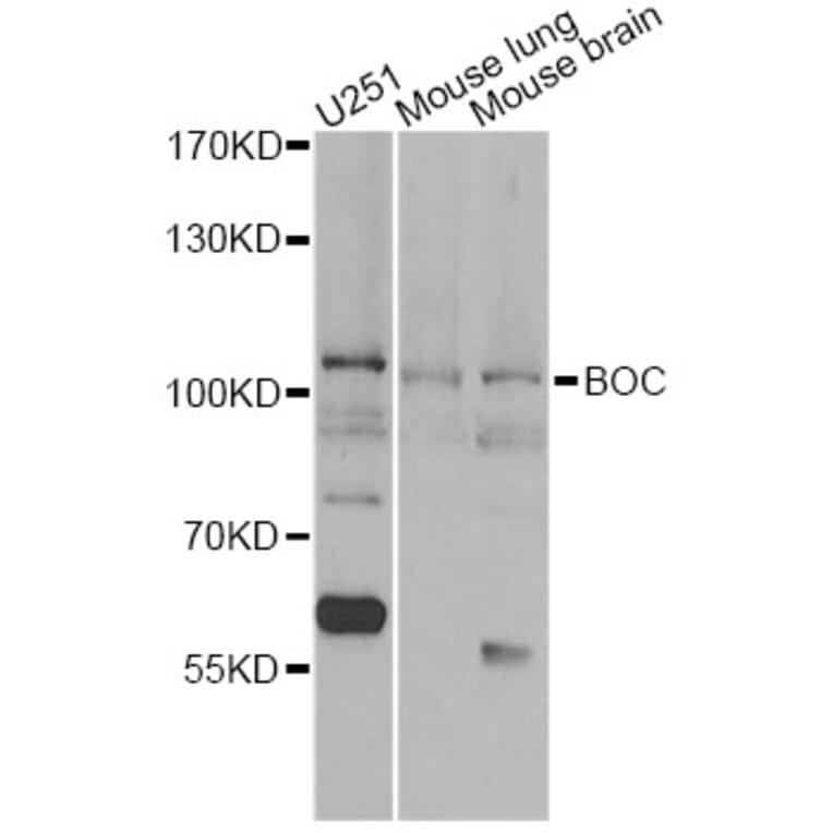 Western Blot - Anti-BOC Antibody (A13446) - Antibodies.com