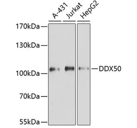 Western Blot - Anti-DDX50 Antibody (A87769) - Antibodies.com