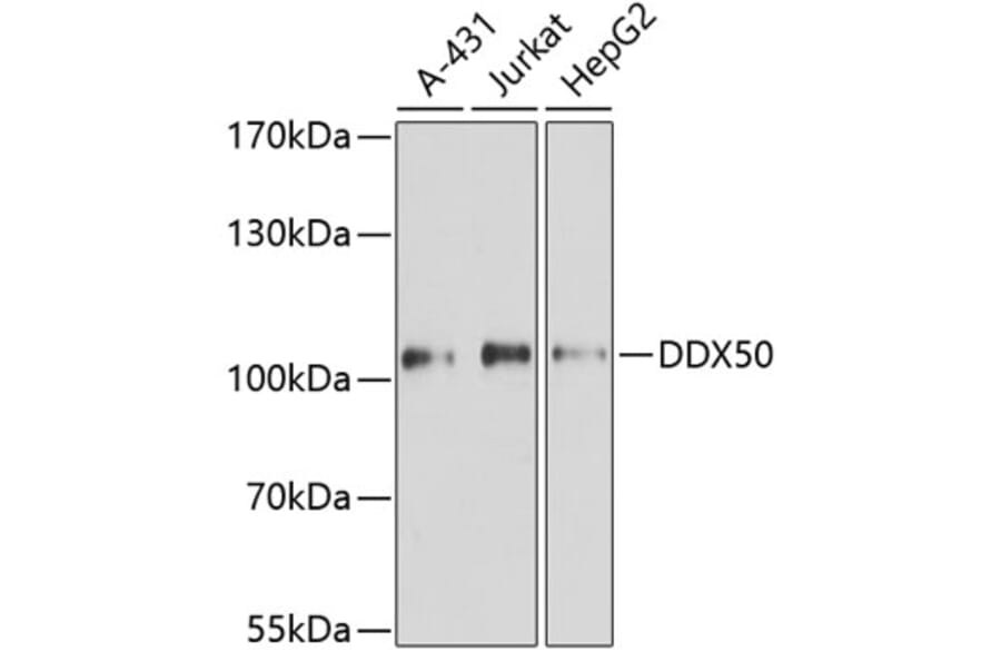 Western Blot - Anti-DDX50 Antibody (A87769) - Antibodies.com
