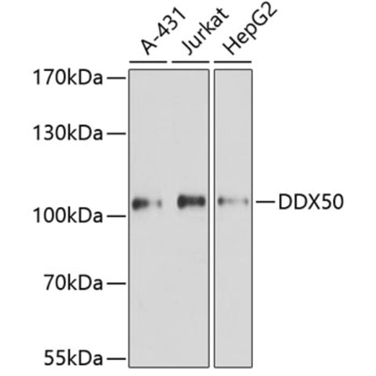 Western Blot - Anti-DDX50 Antibody (A87769) - Antibodies.com