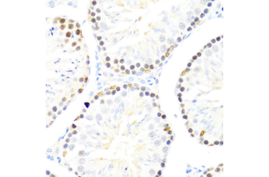 Immunohistochemistry - Anti-DDX50 Antibody (A87769) - Antibodies.com