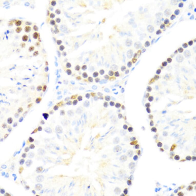Immunohistochemistry - Anti-DDX50 Antibody (A87769) - Antibodies.com
