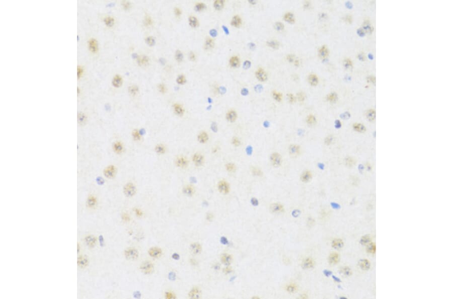 Immunohistochemistry - Anti-DDX50 Antibody (A87769) - Antibodies.com