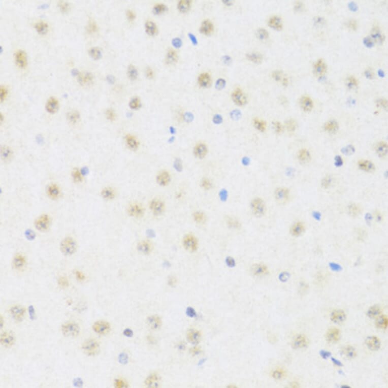 Immunohistochemistry - Anti-DDX50 Antibody (A87769) - Antibodies.com