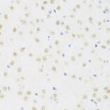 Immunohistochemistry - Anti-DDX50 Antibody (A87769) - Antibodies.com