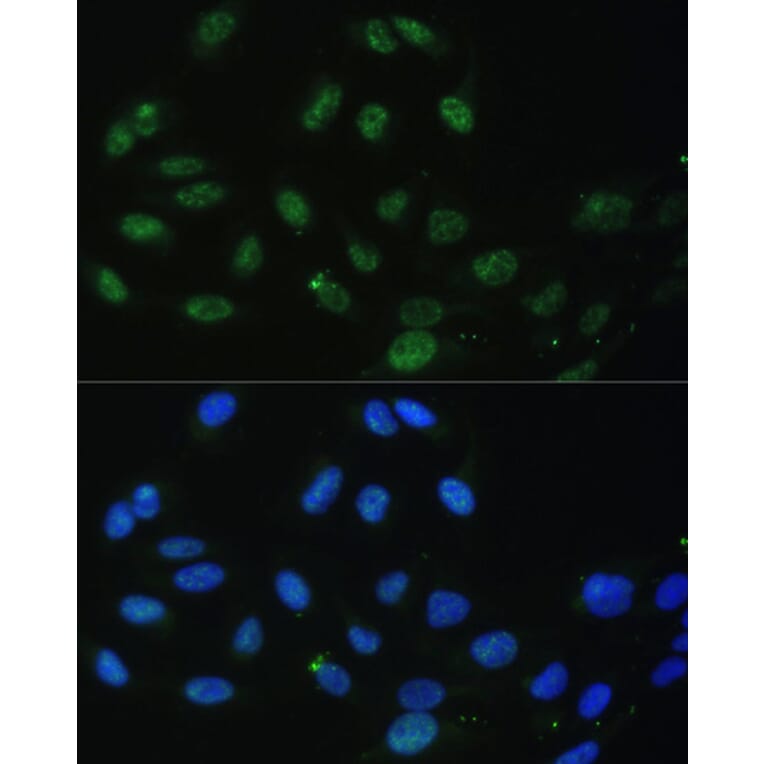 Immunofluorescence - Anti-DDX50 Antibody (A87769) - Antibodies.com