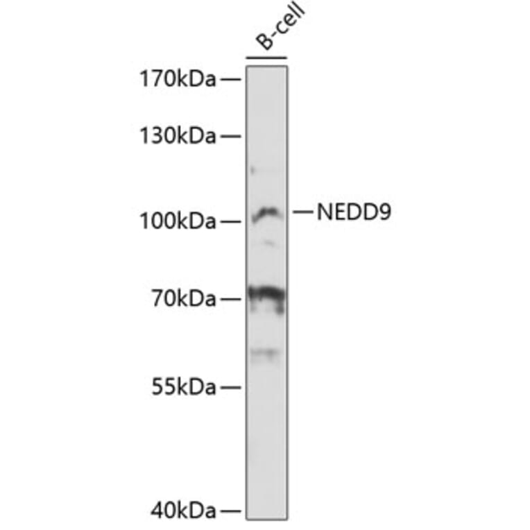 Western Blot - Anti-NEDD9 Antibody (A12010) - Antibodies.com