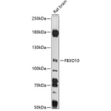 Western Blot - Anti-FBXO10 Antibody (A87771) - Antibodies.com
