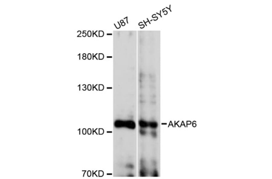 Western Blot - Anti-AKAP6 Antibody (A12798) - Antibodies.com