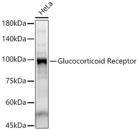 Western Blot - Anti-Glucocorticoid Receptor Antibody (A87773) - Antibodies.com