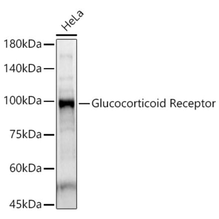 Western Blot - Anti-Glucocorticoid Receptor Antibody (A87773) - Antibodies.com