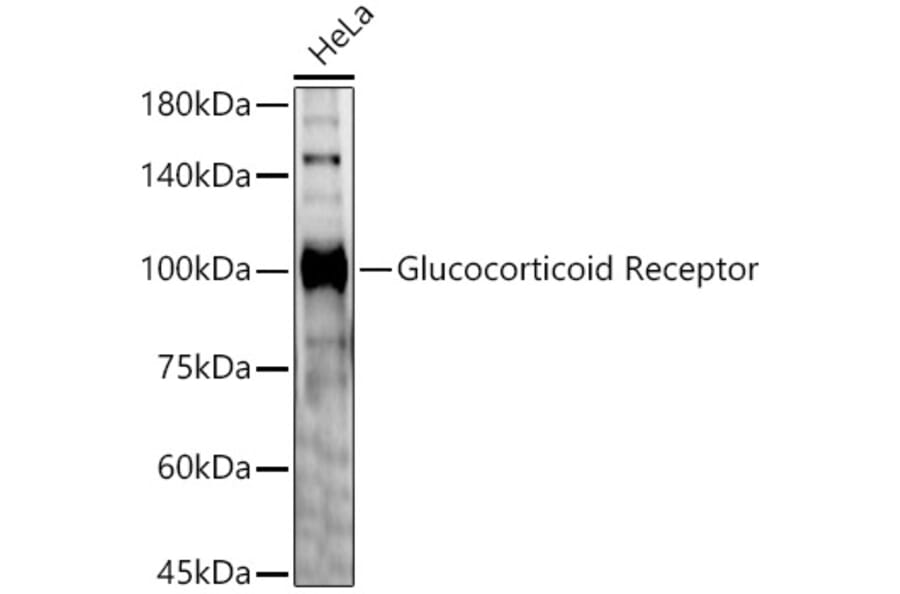 Western Blot - Anti-Glucocorticoid Receptor Antibody (A87773) - Antibodies.com