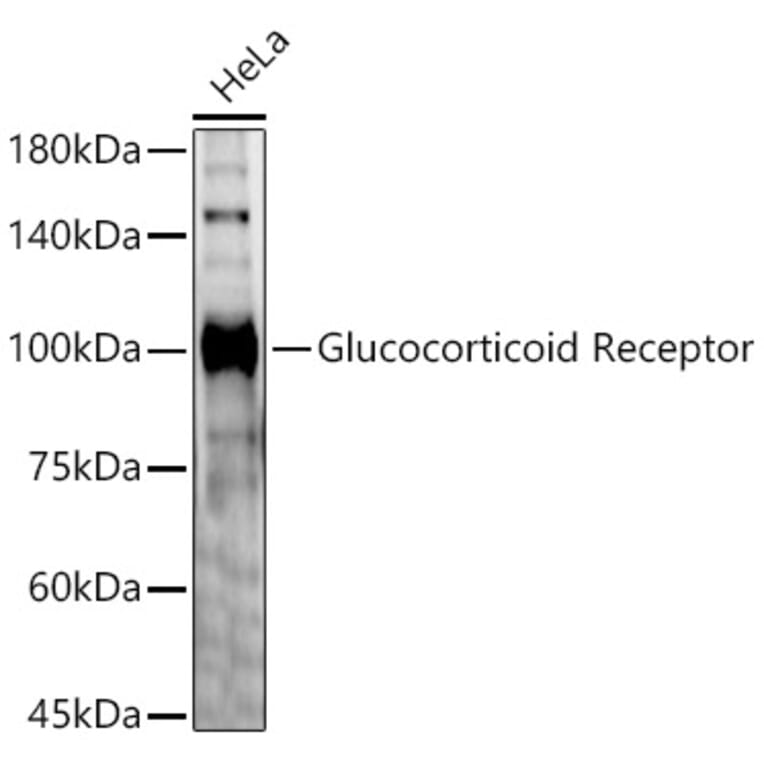 Western Blot - Anti-Glucocorticoid Receptor Antibody (A87773) - Antibodies.com