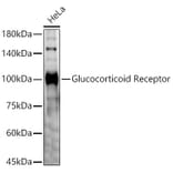 Western Blot - Anti-Glucocorticoid Receptor Antibody (A87773) - Antibodies.com