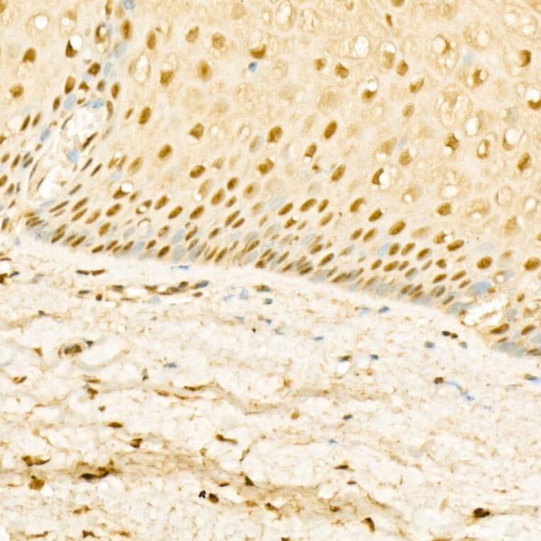 Immunohistochemistry - Anti-Glucocorticoid Receptor Antibody (A87773) - Antibodies.com
