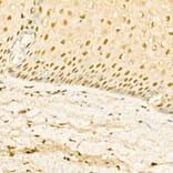 Immunohistochemistry - Anti-Glucocorticoid Receptor Antibody (A87773) - Antibodies.com