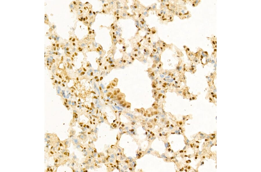 Immunohistochemistry - Anti-Glucocorticoid Receptor Antibody (A87773) - Antibodies.com