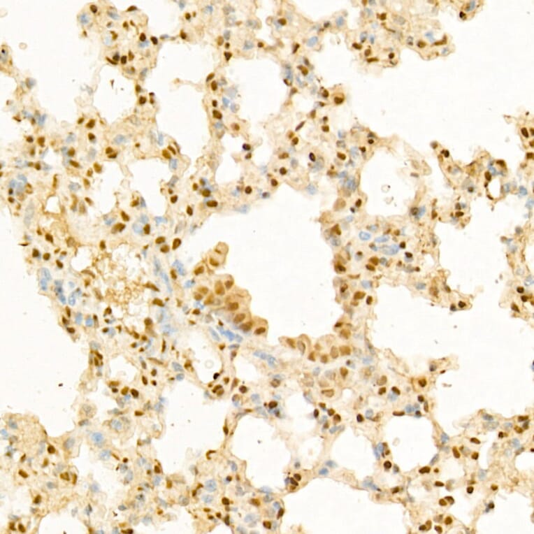 Immunohistochemistry - Anti-Glucocorticoid Receptor Antibody (A87773) - Antibodies.com
