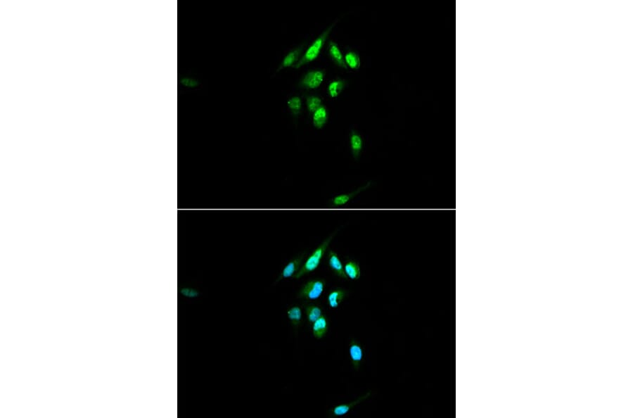 Immunofluorescence - Anti-Glucocorticoid Receptor Antibody (A87773) - Antibodies.com