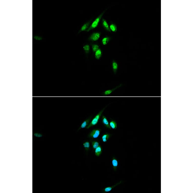 Immunofluorescence - Anti-Glucocorticoid Receptor Antibody (A87773) - Antibodies.com