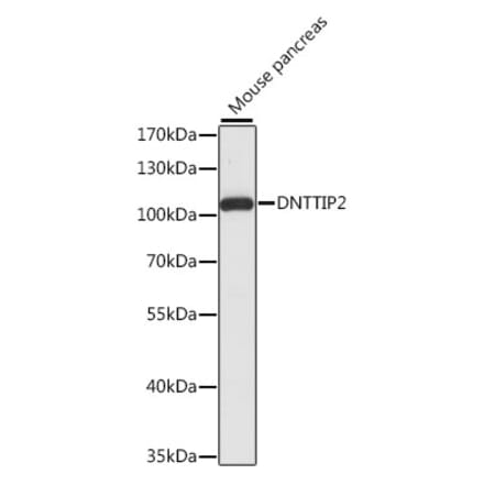 Western Blot - Anti-DNTTIP2 Antibody (A87774) - Antibodies.com