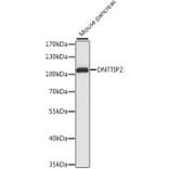 Western Blot - Anti-DNTTIP2 Antibody (A87774) - Antibodies.com