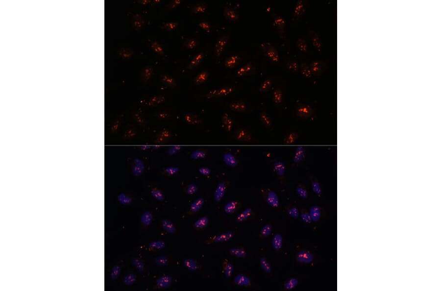 Immunofluorescence - Anti-DNTTIP2 Antibody (A87774) - Antibodies.com
