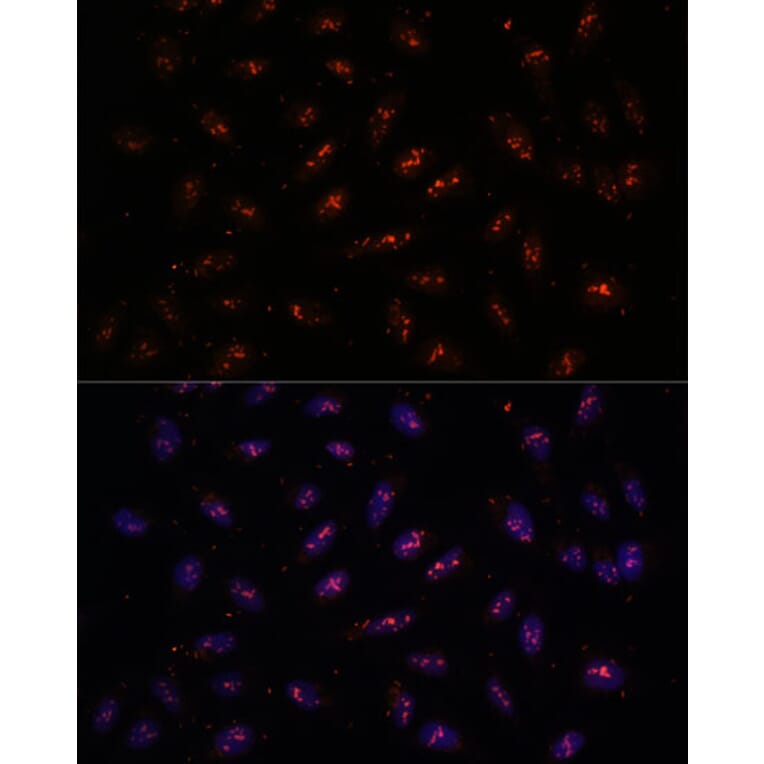 Immunofluorescence - Anti-DNTTIP2 Antibody (A87774) - Antibodies.com