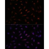 Immunofluorescence - Anti-DNTTIP2 Antibody (A87774) - Antibodies.com