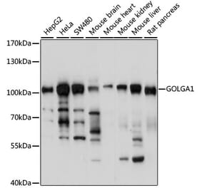 Western Blot - Anti-Golgin 97 Antibody (A87775) - Antibodies.com