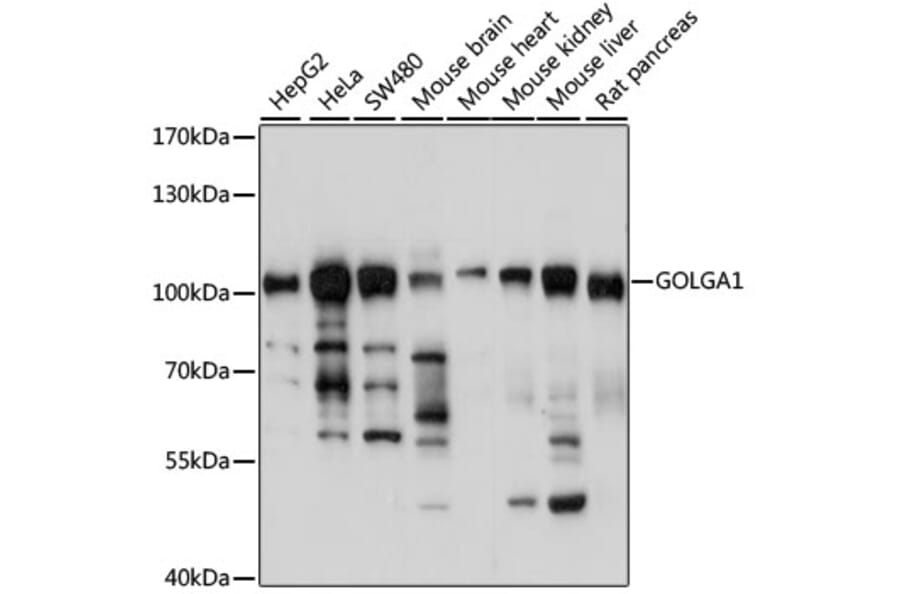 Western Blot - Anti-Golgin 97 Antibody (A87775) - Antibodies.com