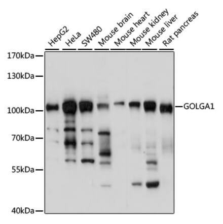 Western Blot - Anti-Golgin 97 Antibody (A87775) - Antibodies.com