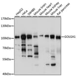 Western Blot - Anti-Golgin 97 Antibody (A87775) - Antibodies.com