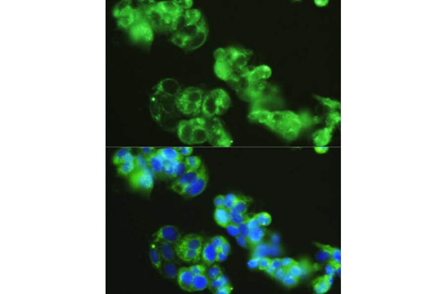 Immunofluorescence - Anti-Golgin 97 Antibody (A87775) - Antibodies.com