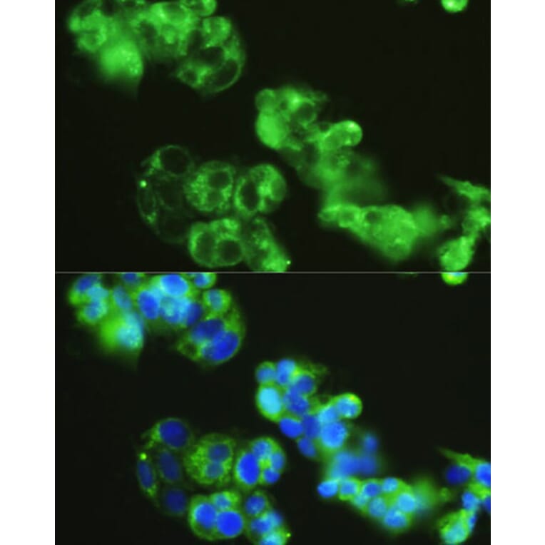 Immunofluorescence - Anti-Golgin 97 Antibody (A87775) - Antibodies.com