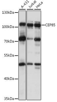 Western blot analysis of extracts of various cell lines, using Anti-CEP85 Antibody (A15891) at 1:1,000 dilution.
Secondary antibody: Goat Anti-Rabbit IgG (H+L) (HRP) (AS014) at 1:10,000 dilution.
Lysates / proteins: 25µg per lane.
Blocking buffer: 3% non-fat dry milk in TBST.
Detection: ECL Basic Kit (RM00020).
Exposure time: 10s.