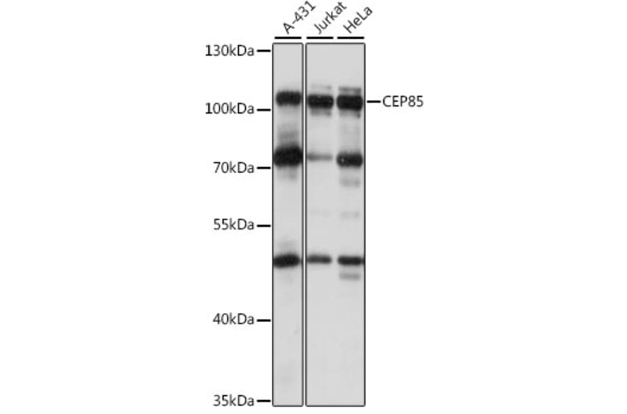 Western Blot - Anti-CCDC21 Antibody (A87776) - Antibodies.com