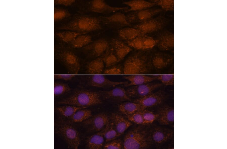 Immunofluorescence - Anti-CCDC21 Antibody (A87776) - Antibodies.com