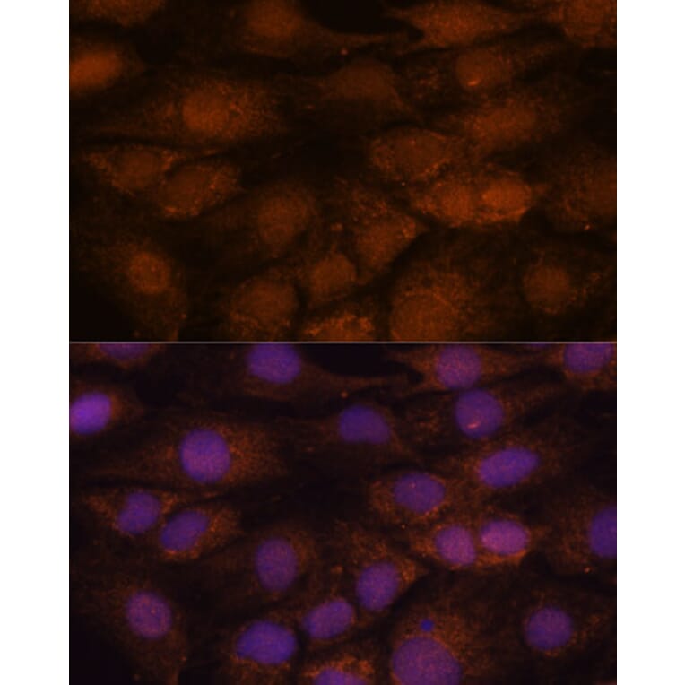 Immunofluorescence - Anti-CCDC21 Antibody (A87776) - Antibodies.com